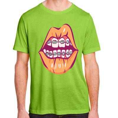 I Just Got Braces Mouth Gift Adult ChromaSoft Performance T-Shirt