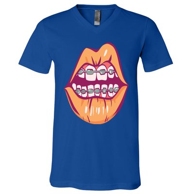 I Just Got Braces Mouth Gift V-Neck T-Shirt