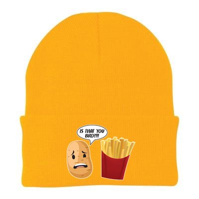 Is That You Bro Funny French Fries Knit Cap Winter Beanie