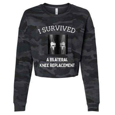 I Survived A Bilateral Knee Replacement Cropped Pullover Crew