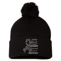 I Wear Black For My Grandma Melanoma Cancer Awareness Pom Pom 12in Knit Beanie