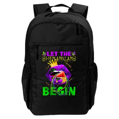 Let The Shenanigans Begin Mardi Gras Backpack