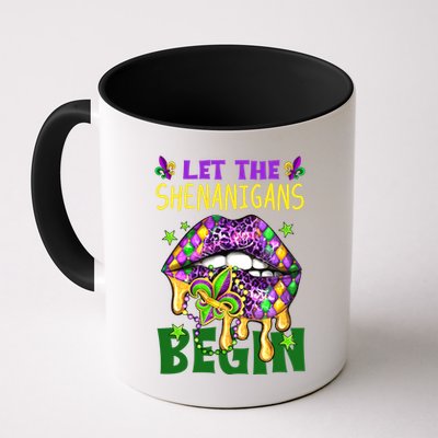 Let The Shenanigans Begin Mardi Gras Lips Mug