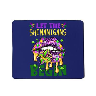 Let The Shenanigans Begin Mardi Gras Lips Mousepad