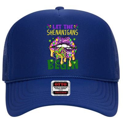 Let The Shenanigans Begin Mardi Gras Lips High Crown Mesh Back Trucker Hat