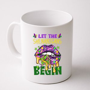 Let The Shenanigans Begin Mardi Gras Lips Coffee Mug