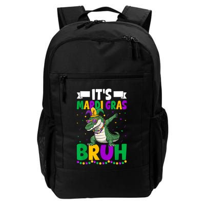 Mardigator Alligator Bruh Mardi Gras Costume Retro Backpack