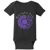 Moebius Syndrome Awareness Sunflower Purple Ribbon Support Gift Baby Bodysuit
