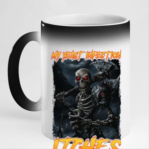 My Yeast Infection Itches 11oz Black Color Changing Mug