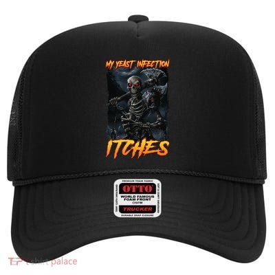 My Yeast Infection Itches High Crown Mesh Back Trucker Hat
