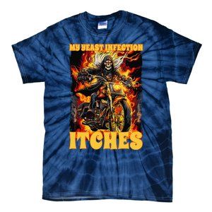 My Yeast Infection Itches Tie-Dye T-Shirt