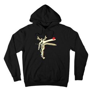 Obgyn Nurse Merry Christmas Reindeer Speculum Xmas Lights Hoodie