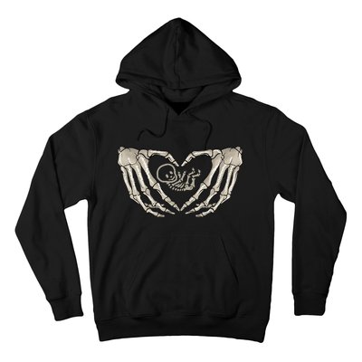 Pregnant Mom Halloween Costume with Xray Skeleton Baby Hoodie