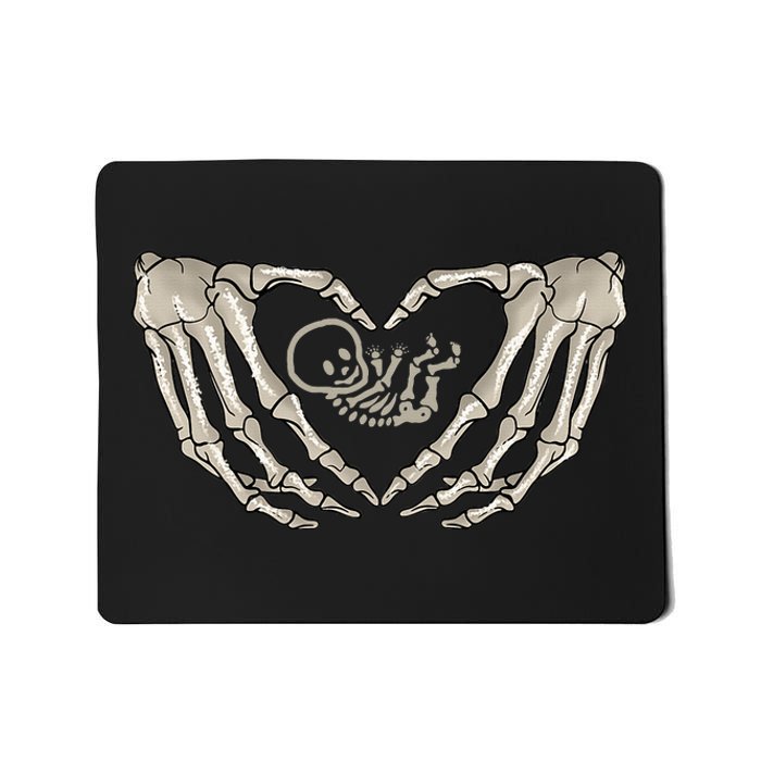 Pregnant Mom Halloween Costume with Xray Skeleton Baby Mousepad