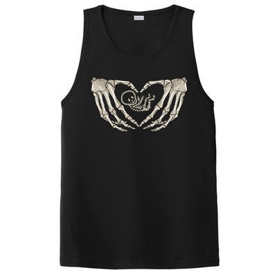 Pregnant Mom Halloween Costume with Xray Skeleton Baby PosiCharge Competitor Tank