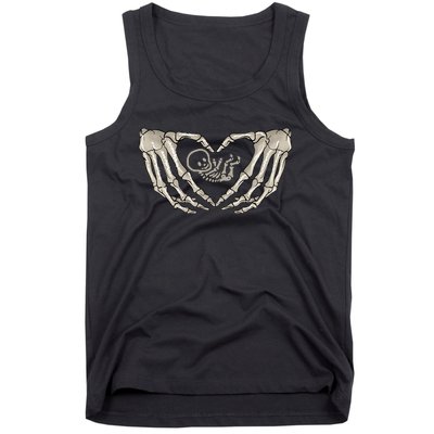 Pregnant Mom Halloween Costume with Xray Skeleton Baby Tank Top