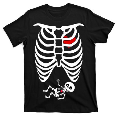 Pregnant Skeleton T-Shirt