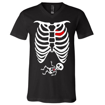 Pregnant Skeleton V-Neck T-Shirt