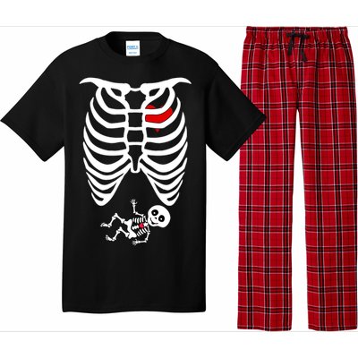 Pregnant Skeleton Pajama Set