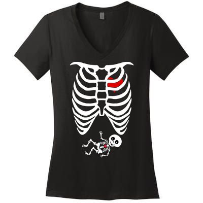 Pregnant Skeleton Women's V-Neck T-Shirt