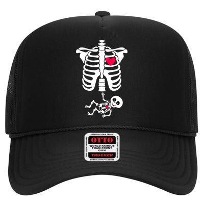 Pregnant Skeleton Ribcage with Baby Costume High Crown Mesh Back Trucker Hat