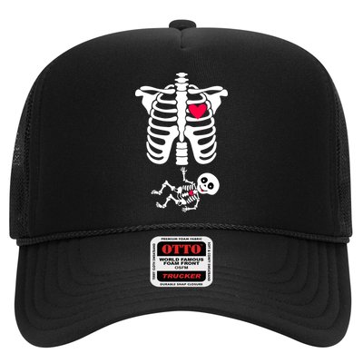 Pregnant Skeleton Ribcage with Baby Costume Trucker Hat