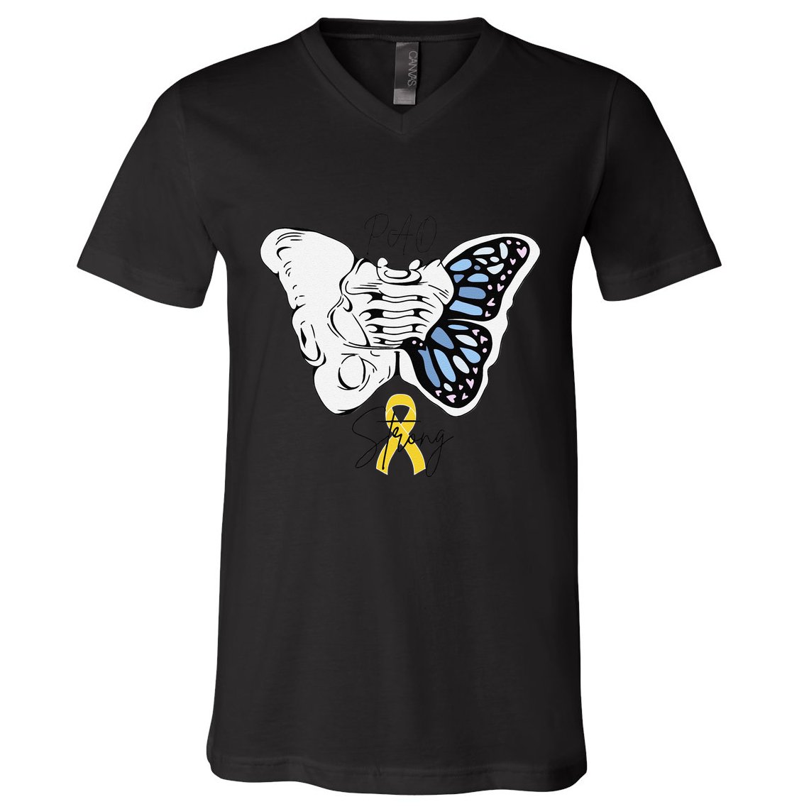 Pao Surgery Strong Hip Surgery Awareness V-Neck T-Shirt