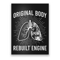 Rebuilt Lung Transplant Survivor Lung Transplant Recovery Poster