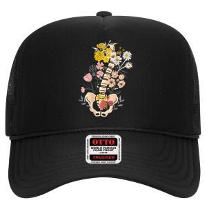 Scoliosis Awareness Spinal Fusion Back Surgery Botanical High Crown Mesh Back Trucker Hat