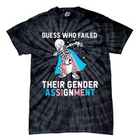 Skeleton Guess Who Failed Their Gender Assignment Tie-Dye T-Shirt