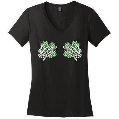 Skeleton Hands Lucky Shamrock Happy St Patricks Day Women's V-Neck T-Shirt