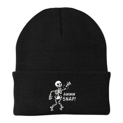 Skeleton Injury Wrist Surgery Recovery Aw Snap Broken Arm Beanie
