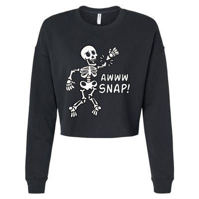 Skeleton Injury Wrist Surgery Recovery Aw Snap Broken Arm Cropped Pullover Crew