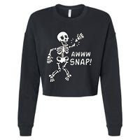 Skeleton Injury Wrist Surgery Recovery Aw Snap Broken Arm Cropped Pullover Crew