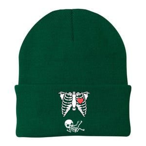 Skeleton Pregnancy Announcement XRay Halloween Costume Knit Cap Winter Beanie