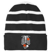 Skeleton Pregnancy Announcement XRay Halloween Costume Striped Beanie with Solid Band