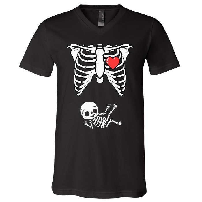 Skeleton Pregnancy Announcement XRay Halloween Costume V-Neck T-Shirt