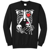 Skeleton Pregnancy Announcement Twins Xray Sweatshirt