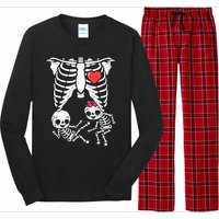 Skeleton Pregnancy Announcement Twins Xray Long Sleeve Pajama Set