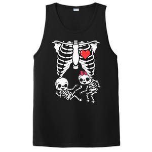 Skeleton Pregnancy Announcement Twins Xray PosiCharge Competitor Tank