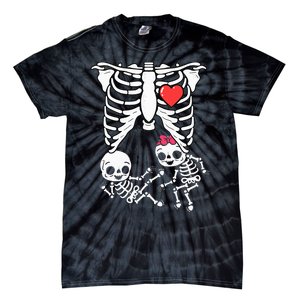 Skeleton Pregnancy Announcement Twins Xray Tie-Dye T-Shirt