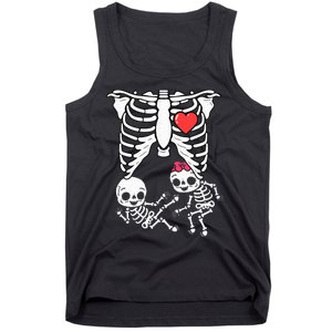 Skeleton Pregnancy Announcement Twins Xray Tank Top