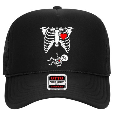 Skeleton Pregnancy Gift Xray Halloween Pregnant Great Gift Trucker Hat