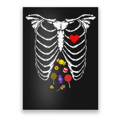 Skeleton Rib Cage Xray Candy Halloween Poster