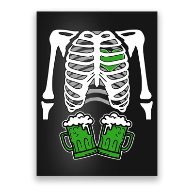 St. Patrick's Day Beer Rib Cage Skeleton Poster