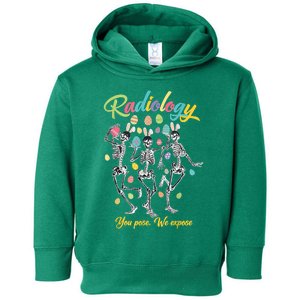 Skeleton You Pose We Expose Funny Easter Radiology Tech Toddler Hoodie