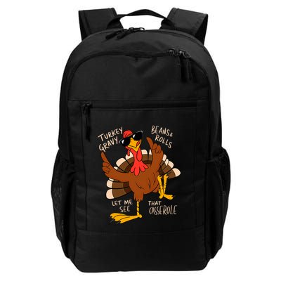 Turkey Gravy Beans And Rolls Casserole Funny Thanksgiving Backpack