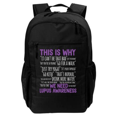This Is Why We Need Lupus Awareness Backpack