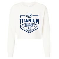 Titanium Spinal Fusion Warrior Spine Surgery Cropped Pullover Crew