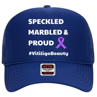 Vitiligo Beauty Speckled Marbled Proud Awareness Ribbon Cute Gift High Crown Mesh Back Trucker Hat